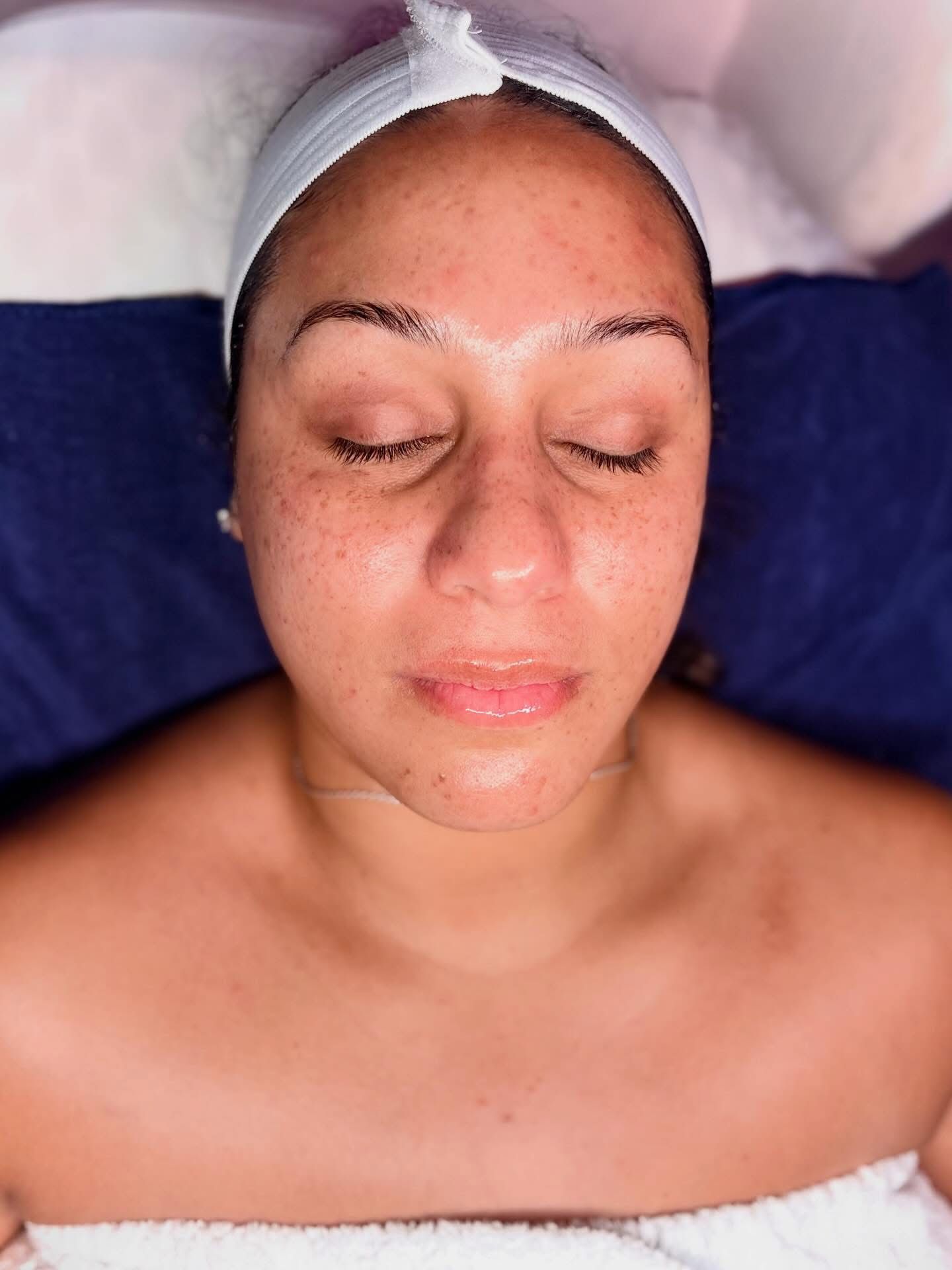Professional facial in a calming treatment setting